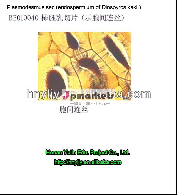 高品質の植物の準備顕微鏡スライド、 secplasmodesmus。( のendospermium黒柿柿)問屋・仕入れ・卸・卸売り