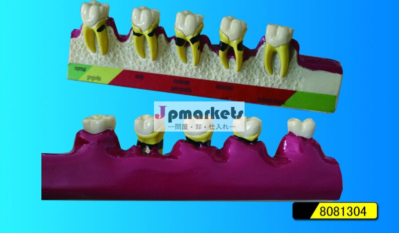 periodontics分類のためのモデル問屋・仕入れ・卸・卸売り