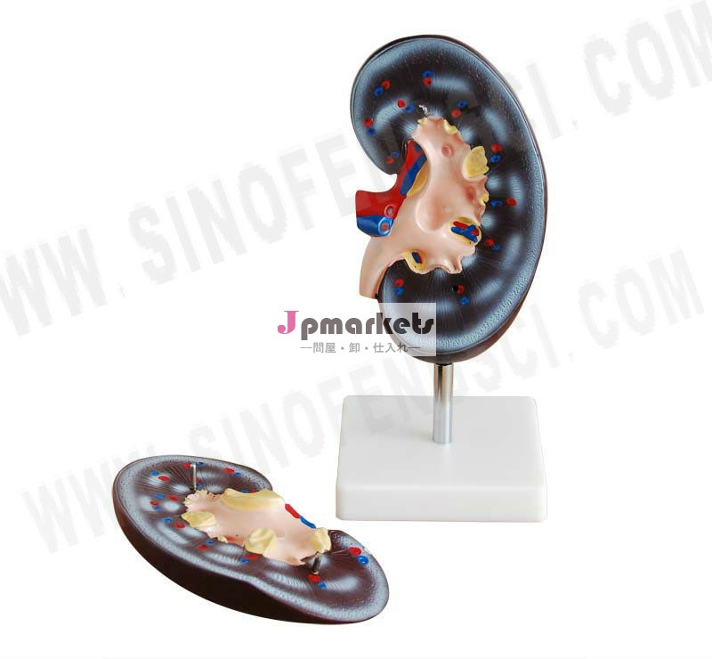 Sf-310-2腎臓モデル( 2部品)問屋・仕入れ・卸・卸売り