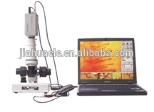高- 品質のビデオnailfoldcapillaroscope/nailbedcapillaroscopy問屋・仕入れ・卸・卸売り