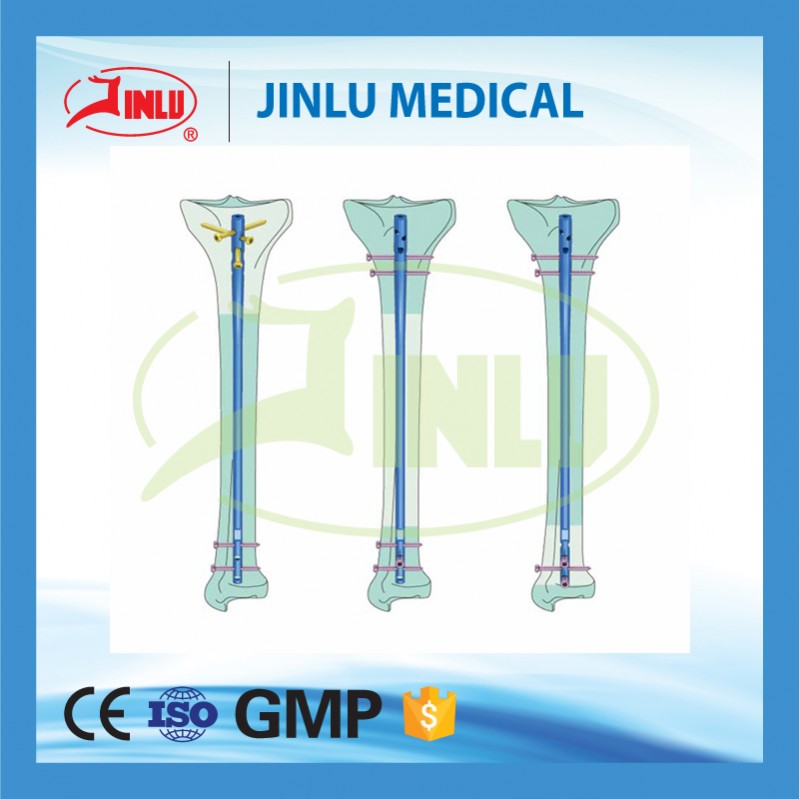 熱い販売のネイル病院jinluosteosynthesis連動爪脛骨( 専門家の設計)、 骨釘専門家タイプ、 整形外科の爪。-移植関連製品問屋・仕入れ・卸・卸売り