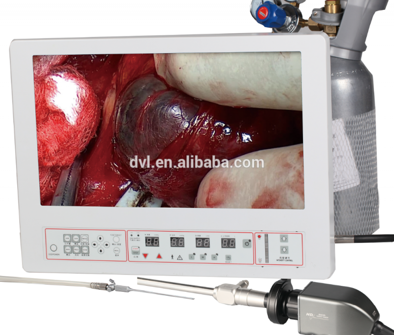 統合された腹腔鏡検査システム-腹部の外科装置問屋・仕入れ・卸・卸売り