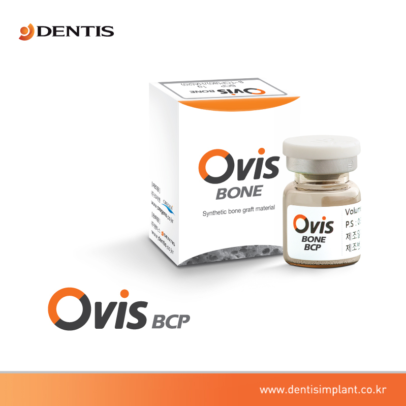 インプラントdentis合成骨移植材- ovisbcp-他の歯科装置問屋・仕入れ・卸・卸売り