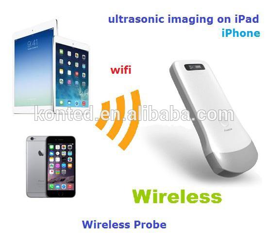 Ipad用プローブ麻酔docotorecografica/iphoneのための超音波トランスデューサー-麻酔の装置及び付属品問屋・仕入れ・卸・卸売り