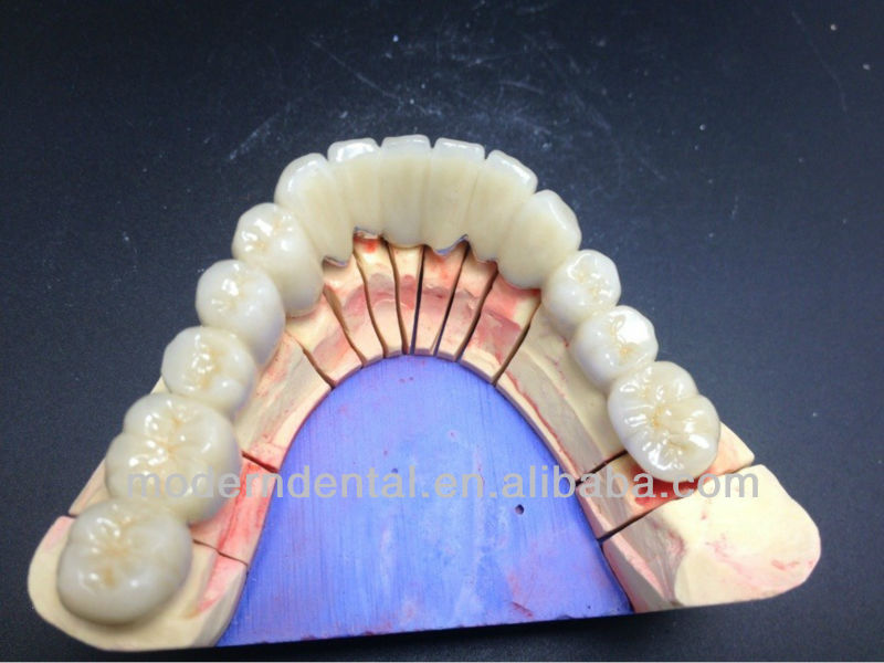 磁器pfmクラウンやブリッジ用co-cr歯科/歯冠を供給する-歯科消耗品問屋・仕入れ・卸・卸売り