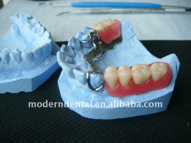 歯科鋳造の部分的な総義歯の供給-歯科消耗品問屋・仕入れ・卸・卸売り