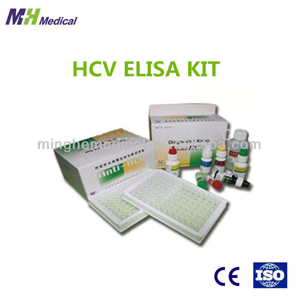 hcvelisaキット-病理学の分析装置問屋・仕入れ・卸・卸売り