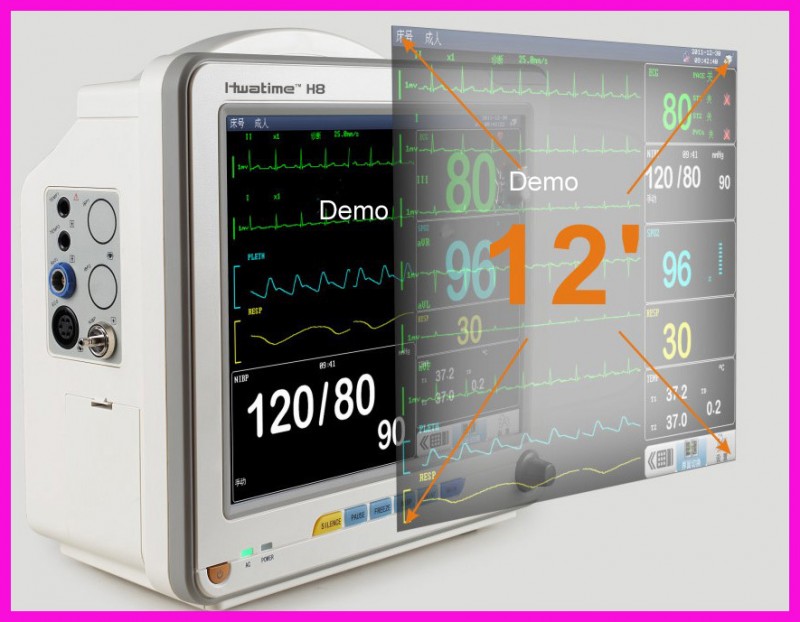 病棟の患者モニタ,携帯型LCDモニター-血圧のモニター問屋・仕入れ・卸・卸売り