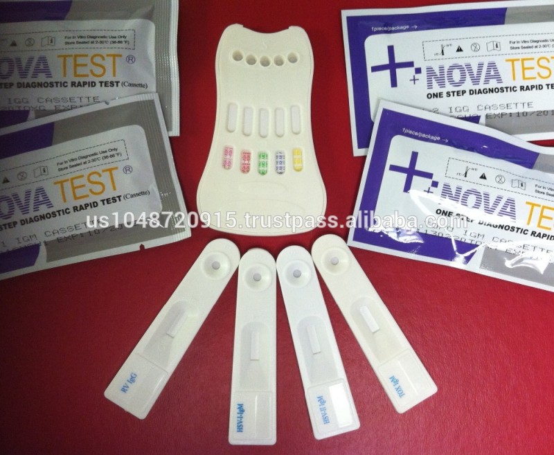 トーチ( toxo/cmv/rv/hsv1・2) ウイルス検査、 血清中/plasma-病理学の分析装置問屋・仕入れ・卸・卸売り