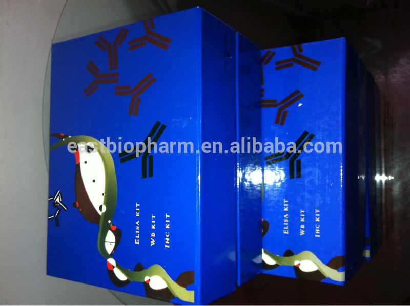 ファッション2015タイプ3ウシパラインフルエンザウイルス抗体( piv3- ab) elisaキット-病理学の分析装置問屋・仕入れ・卸・卸売り