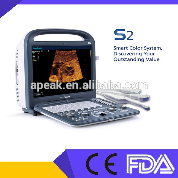 fdas2sonoscape超音波マシンポータブル、 ce認定品-携帯用超音波診断装置問屋・仕入れ・卸・卸売り