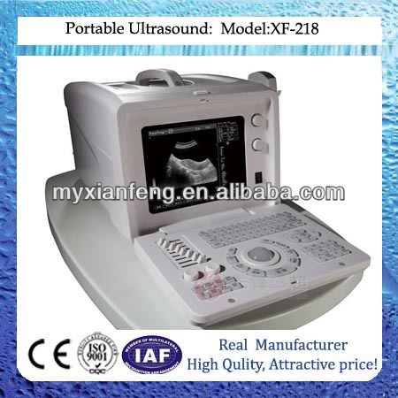 中国xf-218bフルデジタルポータブル超音波スキャナ-携帯用超音波診断装置問屋・仕入れ・卸・卸売り