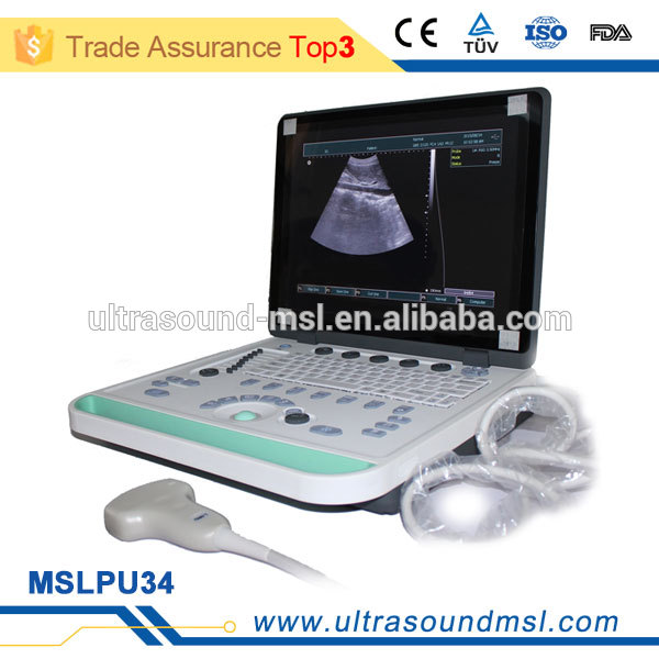高品質な3dmslpu34zラップトップの超音波装置のための妊娠検査-携帯用超音波診断装置問屋・仕入れ・卸・卸売り