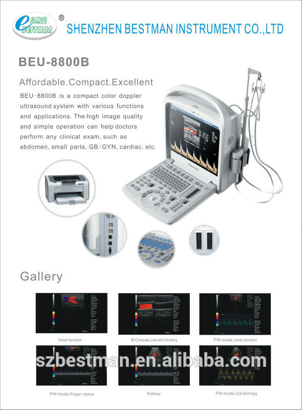 販売-- 3dbeu-8880ポータブル超音波診断機-携帯用超音波診断装置問屋・仕入れ・卸・卸売り