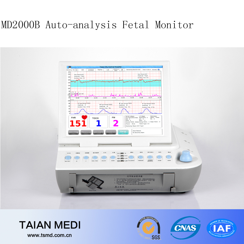 ほとんどの専門を持つ胎児のモニター最も開発されたソフトウェア-携帯用超音波診断装置問屋・仕入れ・卸・卸売り