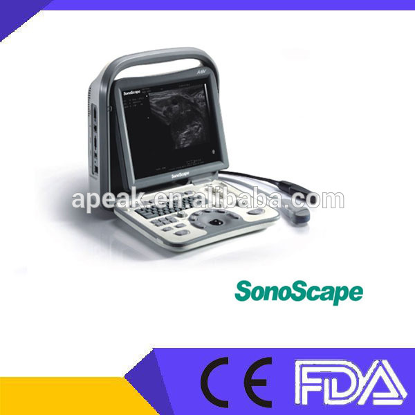 Sonoscapea6黒と白のポータブル超音波機器fda、 腹部にce認定品、、 msk、/obgyn、 血管-携帯用超音波診断装置問屋・仕入れ・卸・卸売り