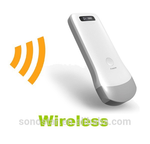 Uprobe- 2ハンドヘルドワイヤレス超音波スキャナ( iphone・ipad上で動作)-携帯用超音波診断装置問屋・仕入れ・卸・卸売り