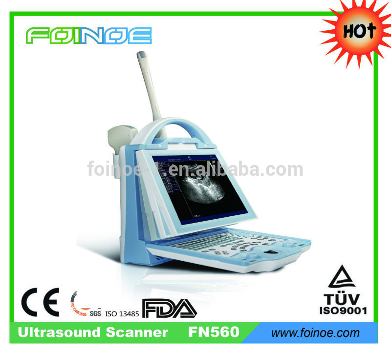モデル: fn560医療診断機器-携帯用超音波診断装置問屋・仕入れ・卸・卸売り