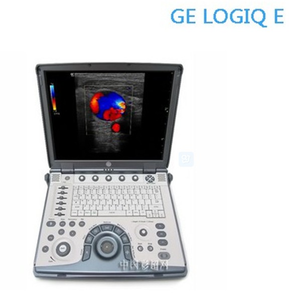 gelogiqe3dポータブルカラー超音波機器-携帯用超音波診断装置問屋・仕入れ・卸・卸売り