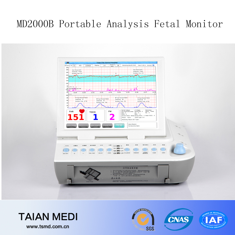 最高の胎児のモニターに基づいて開発したハードウェアとソフトウェア-携帯用超音波診断装置問屋・仕入れ・卸・卸売り