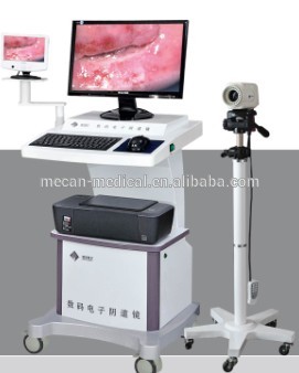 Mce- exrh- 220fデジタル電子の膣鏡膣検査のための機器-電子内視鏡問屋・仕入れ・卸・卸売り