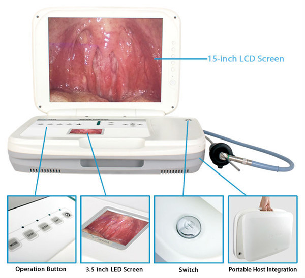 医療の内視鏡カメラ腹腔鏡検査装置-電子内視鏡問屋・仕入れ・卸・卸売り
