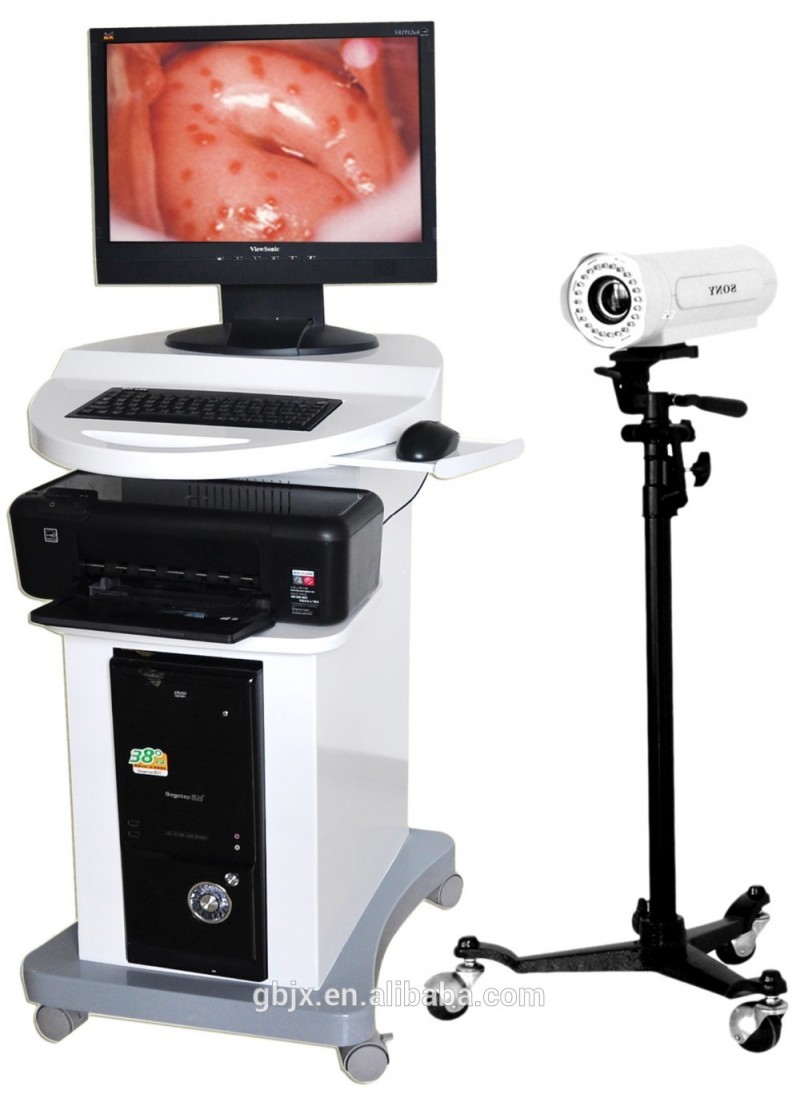 コルポスコピーled-2000digitalelectronic800医療・健康における、 婦人科用000ピクセル-電子内視鏡問屋・仕入れ・卸・卸売り