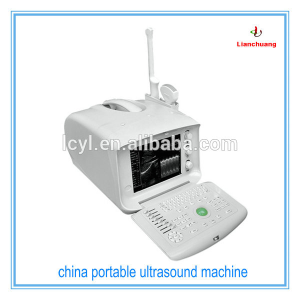 中国携帯型超音波マシンの価格-携帯用超音波診断装置問屋・仕入れ・卸・卸売り