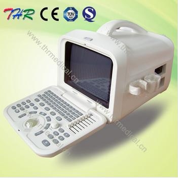 Thr-us6601medicalフルデジタルポータブル超音波スキャナ-レーザーの診断装置問屋・仕入れ・卸・卸売り