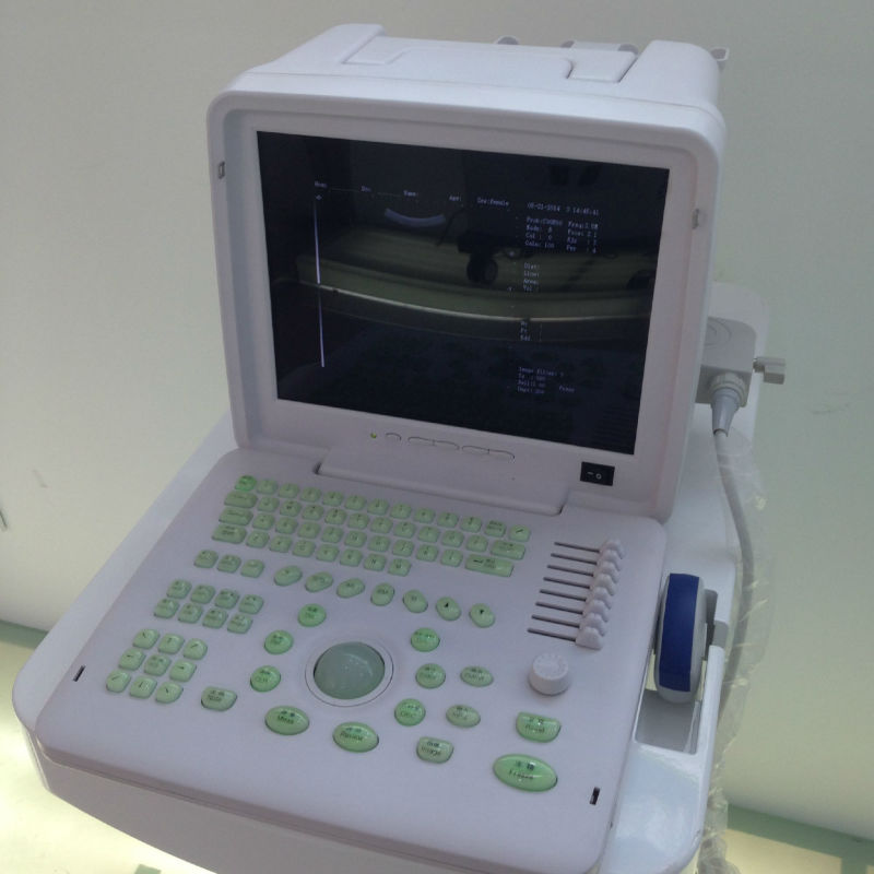 ポータブル検査超音波検査・超音波dw360医療機器の診断-RF療法装置問屋・仕入れ・卸・卸売り