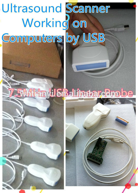 usb超音波プローブタブレットコンピュータのノートパソコン用-携帯用超音波診断装置問屋・仕入れ・卸・卸売り