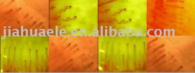 釘の折目のmicrocirculationの検光子-医学の拡大鏡問屋・仕入れ・卸・卸売り