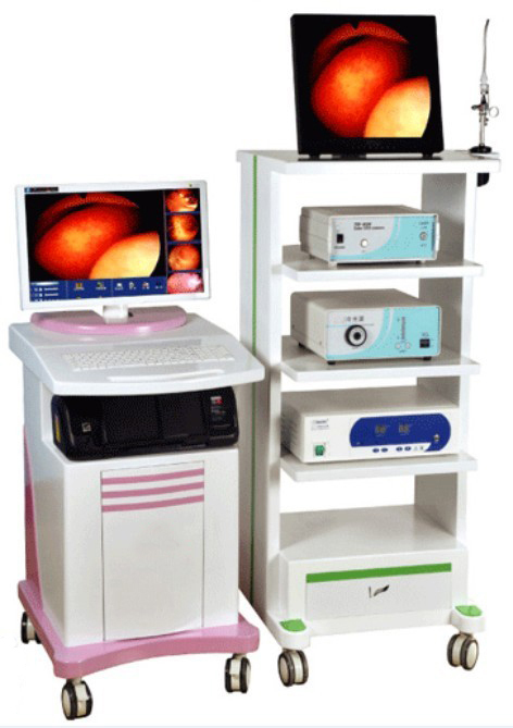 子宮鏡デジタル診断システム( l01669)-光学内視鏡及び付属品問屋・仕入れ・卸・卸売り