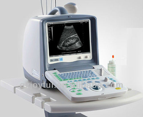 ポータブル診断超音波機器の価格-母性新生児の超音波モニター問屋・仕入れ・卸・卸売り