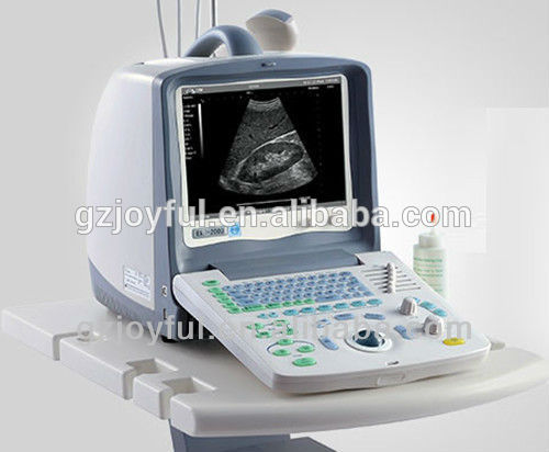 妊娠診断する超音波スキャナ-母性新生児の超音波モニター問屋・仕入れ・卸・卸売り