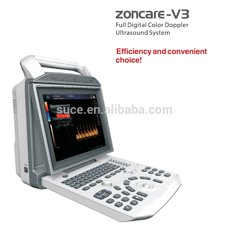 Zoncare- v3ポータブルデジタルカラードップラー超音波ceを搭載したマシン-色のドップラー超音波装置問屋・仕入れ・卸・卸売り