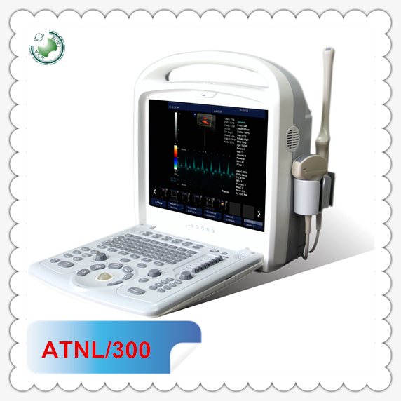 Atnl/300携帯型超音波マシンカラードップラー超音波機器-色のドップラー超音波装置問屋・仕入れ・卸・卸売り