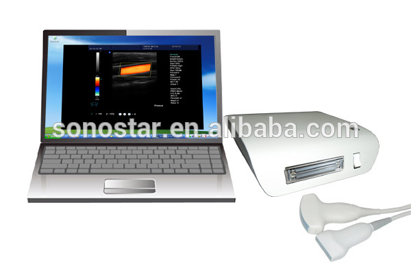 alibabaの熱い販売陶磁器2dポータブルカラードップラー-色のドップラー超音波装置問屋・仕入れ・卸・卸売り