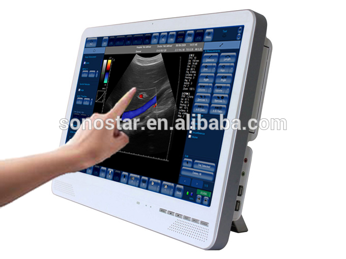 カスタマイズされたホット- 売却2015有用な4dカラードップラー-色のドップラー超音波装置問屋・仕入れ・卸・卸売り