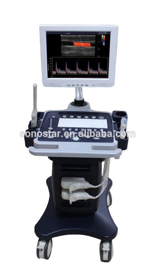 安いhotsellob取材チーム4dカラードップラー-色のドップラー超音波装置問屋・仕入れ・卸・卸売り