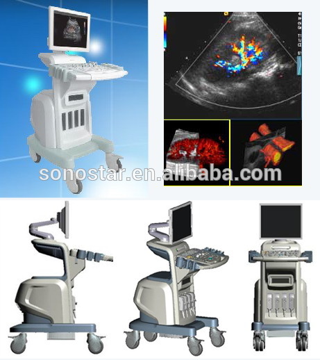 エコデザインのアンティーク4dカラードップラー-色のドップラー超音波装置問屋・仕入れ・卸・卸売り