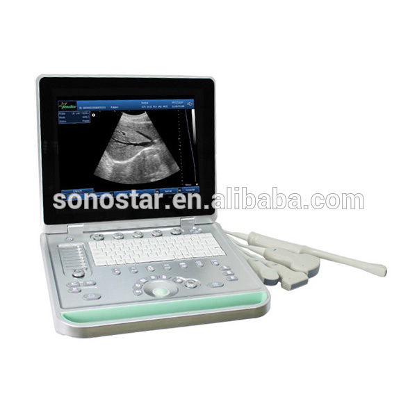 SS-9 PC Based Laptop Ultrasound B scanner(ultrasound, ultrasoni, scanner)-色のドップラー超音波装置問屋・仕入れ・卸・卸売り