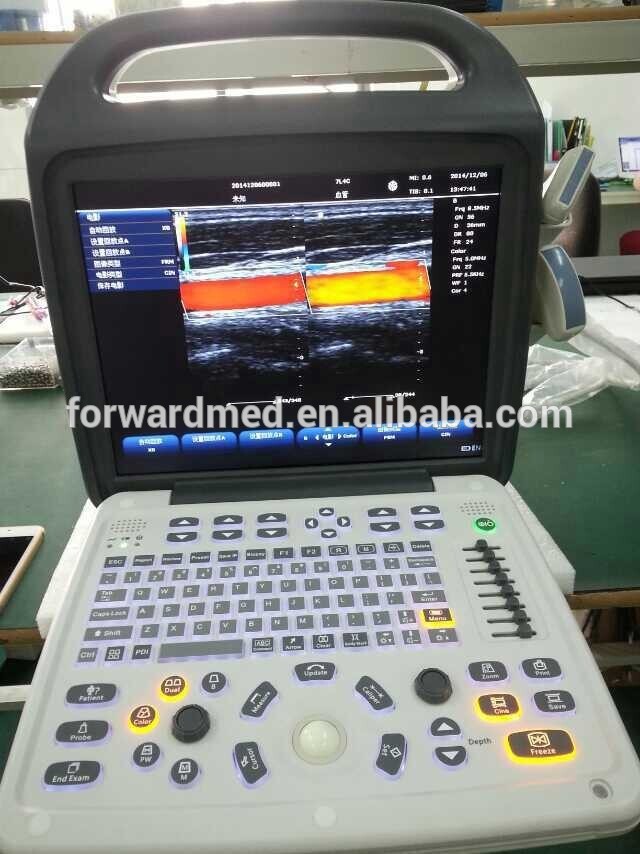 ポータブルカラードップラー心臓血管超音波機器-色のドップラー超音波装置問屋・仕入れ・卸・卸売り