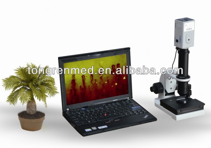 微小循環顕微鏡tr8000bラップトップタイプ( ik)-顕微鏡問屋・仕入れ・卸・卸売り