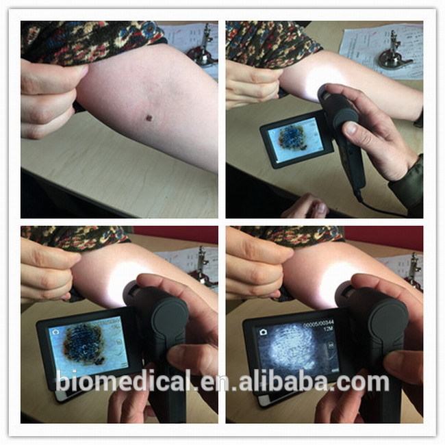 皮膚の解析カメラusbのオトスコープ内視鏡ビデオカメラ-顕微鏡問屋・仕入れ・卸・卸売り