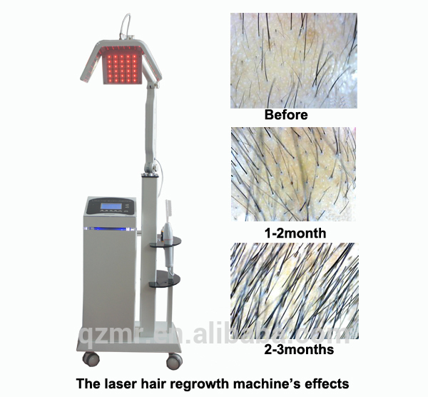 髪の成長diod650nmの脱毛のレーザー脱毛の療法( qz- 2029年)問屋・仕入れ・卸・卸売り